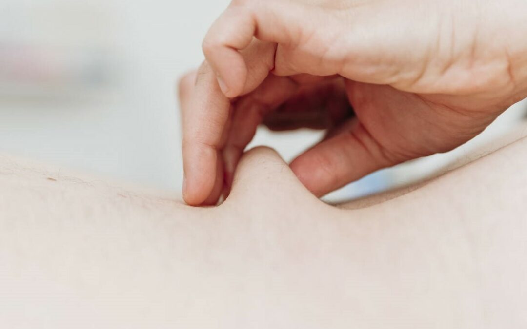 Bindergewebe Massage